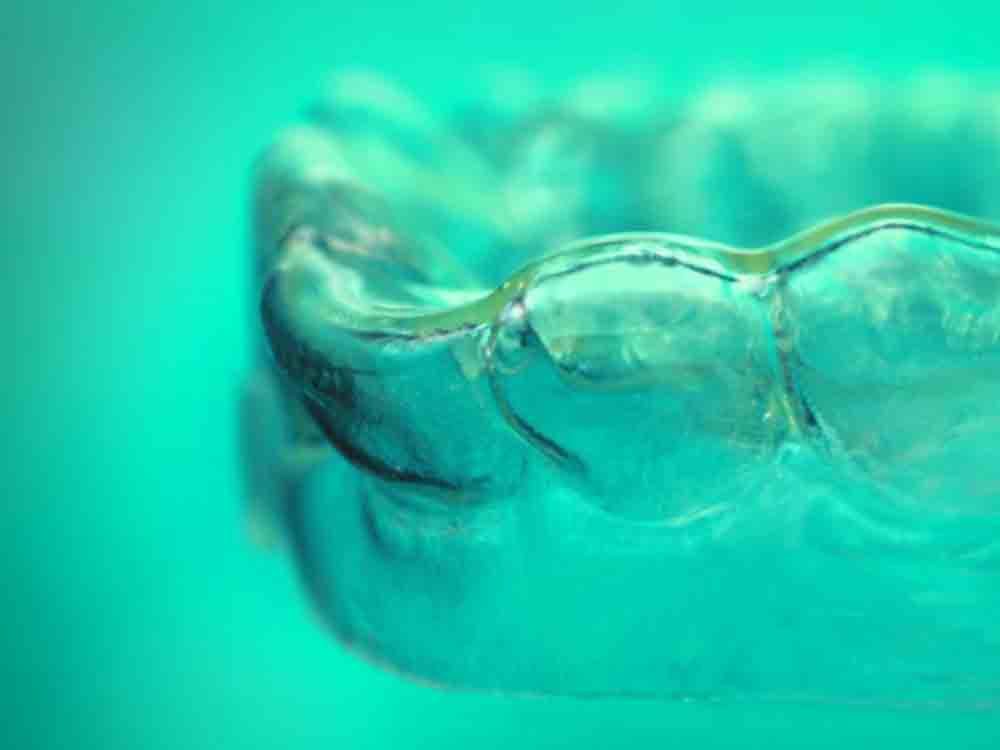 Intelligente Materialien für die Aligner Therapie: nachhaltiger, kostengünstiger, schonender, Fraunhofer Institut für Angewandte Polymerforschung IAP Intelligente Materialien für die Aligner Therapie: nachhaltiger, kostengünstiger, schonender, Fraunhofer Institut für Angewandte Polymerforschung IAP